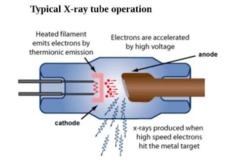 X Rays Diagram