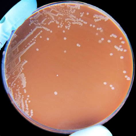 Haemophilus influenzae bacteria most often cause pneumonia, bacteremia, and meningitis mostly in infants and children younger than five years of age. Haemophilus influenzae - Wikipedia