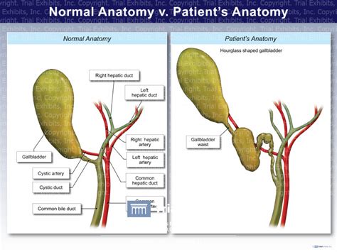 Normal Gallbladder V Patients Anatomy Trialexhibits Inc