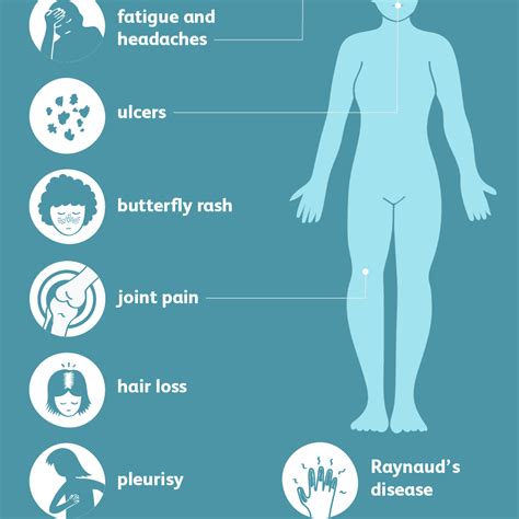 Lupus Signs Symptoms And Complications