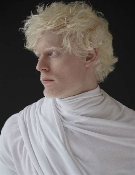 Stephen Thompson By Ckarantzolas Albino Model Albino Human Stephen