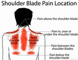 Shoulder blade (scapula) pain causes, symptoms, treatments, and exercises