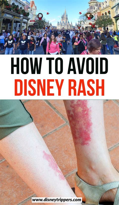 How To Avoid Disneys Red Stains On The Legs And Feet In An Amusement Park