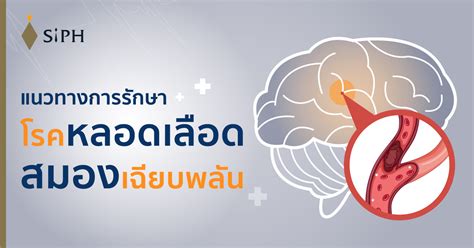 แนวทางการรักษาโรคหลอดเลือดสมองเฉียบพลัน Treatment Of Stroke