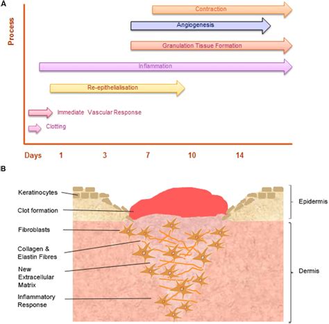 Start studying cutaneous wound healing lecture. The temporal stages of cutaneous wound healing and key ...
