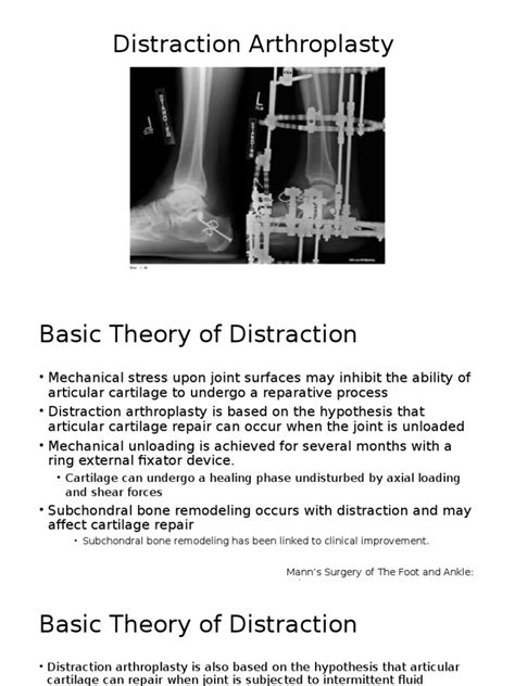 Ankle Distraction Arthroplasty Osteoarthritis Ankle
