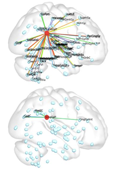Cognition And Behavior Autism Traits Predict Connectivity Spectrum Autism Research News