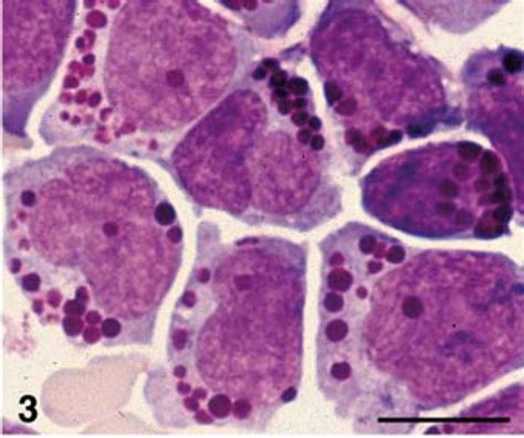 Feline Large Granular Lymphocyte Lgl Lymphoma With Secondary Leukemia