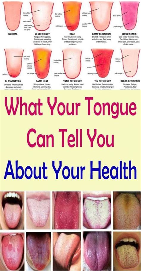 What Your Tongue Can Tell You About Your Health A Thin Tongue Is A Sign Of Dehydration Or Show