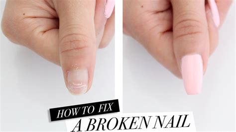In this video we will break down the options and show. Nail repairs and what are nail repair costs associated ...