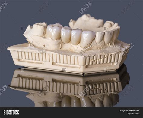 They are milled to their 10. Monolithic Zirconia Image & Photo (Free Trial) | Bigstock
