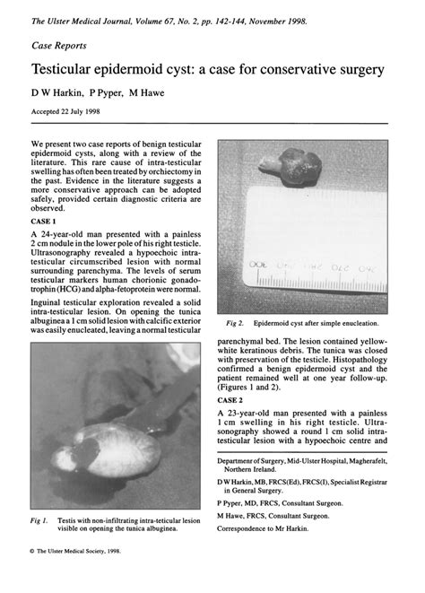 Pdf Testicular Epidermoid Cyst A Case For Conservative Surgery