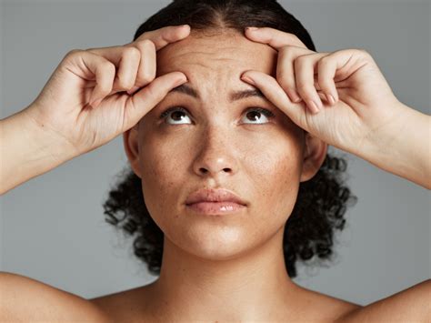 Get Rid Of Forehead Wrinkles 10 Essential Tips For Women In Their 30s