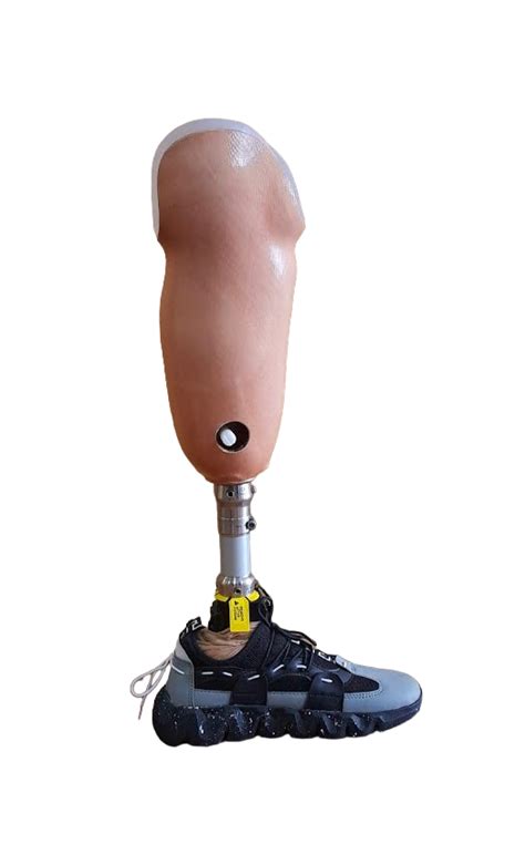 Functional Prosthetic Ossur Flex Foot Assure Below Knee Prosthesis
