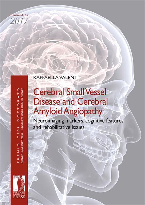 Cerebral Small Vessel Disease And Cerebral Amyloid Angiopathy Firenze