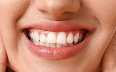 Healthy Gums 8 Best Easy Tips To Keep Your Gums Healthy