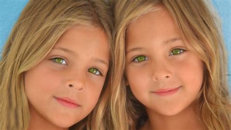 These Identical Twins Were Named Most Beautiful In The World See My