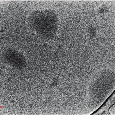 Bright Field Transmission Electron Microscopy Tem Image Of Polylysine