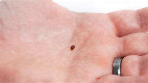 Pest Control Pro Tips How Did Bed Bugs Get Into Our Bed Greenstorehk