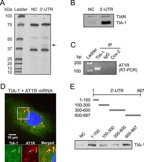 Cytoplasmic Association Of Tia 1 With At1r Mrna In Vsmcs A Proteins