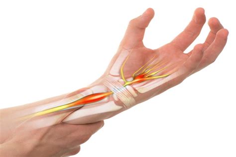 5 Causes Of Wrist Pain You Should Never Ignore Page 6 Of 7 Betahealthy