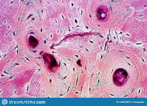 Histology Of Human Compact Bone Tissue Under Microscope View For Stock