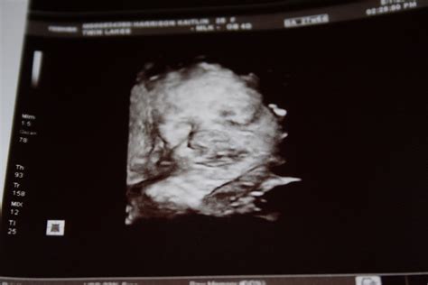 How much is a 3d ultrasound uk. Harrison Homeplace: 4D Ultrasound