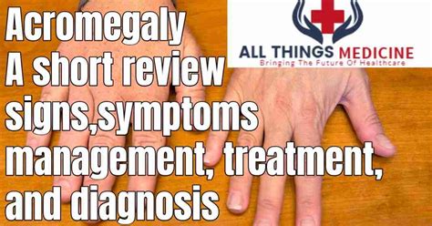 acromegaly a short review signs and symptoms management diagnosis and all