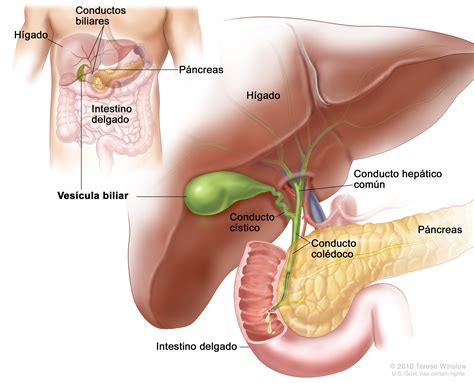 Tratamiento del cáncer de vesícula biliar NCI