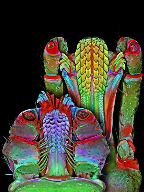Stunning Images From The Small World Microscopic Art Competition