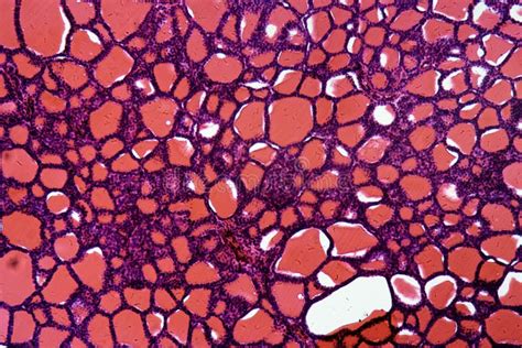 Thyroid Gland Cells Under The Microscope Stock Photo Image Of