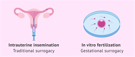Fertility Treatments Used In Surrogacy