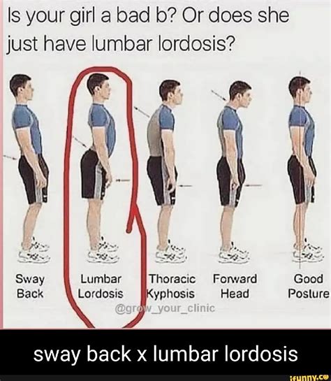 Is Your Girl A Bad B Or Does She Just Have Lumbar Lordosis Ii Sway Ii