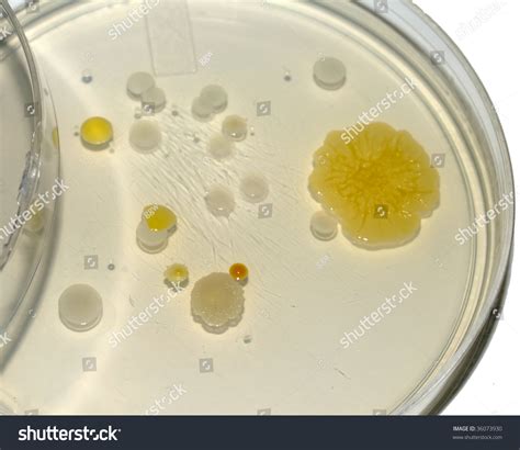 Different Colored Bacterial Colonies Growing On Agar Plate Stock Photo