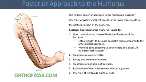 Posterior Approach To The Humerus • Easy Tutorial • Orthofixar 2024