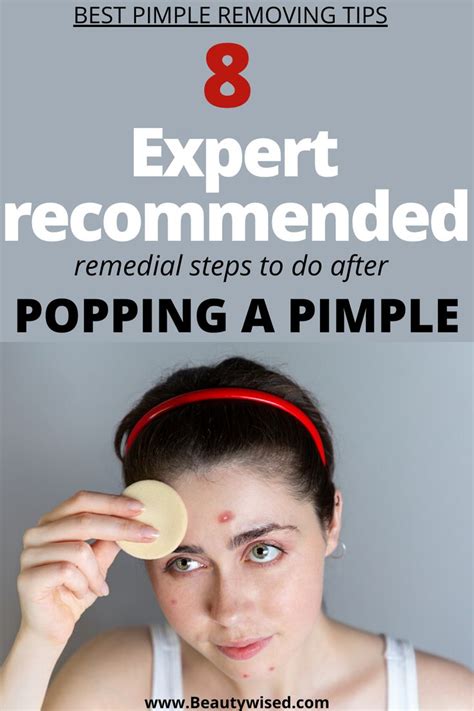 the best pimple popping tips on how to properly pop a pimple or how to prevent scabs formation