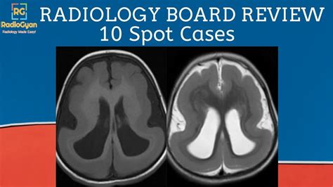 Radiology Board Core Exam Review Cases Quiz And Discussion Set 10