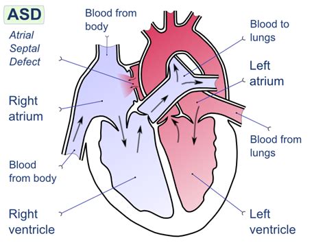 Difference Between Left And Right Side Of Heart Compare The