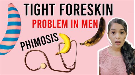 Phimosis Tight Foreskin Problem Youtube