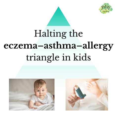 Halting The Eczemaasthmaallergy Triangle In Children — Gutsy By