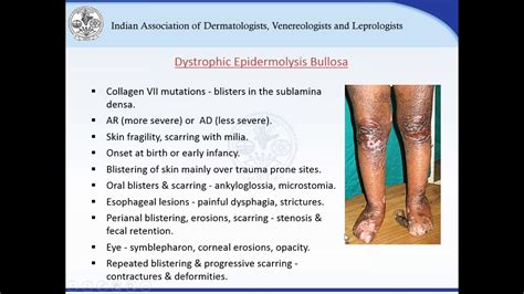 Dermatology Bullous Disorders 🖇 Diagnosis Bullous Disorder Of Skin Ppt