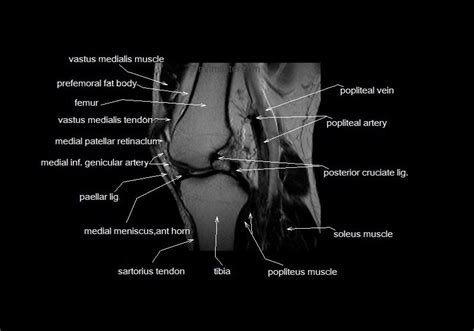 Mri Knee Cross Sectional Anatomy Sagittal Image Knee Mri Knee