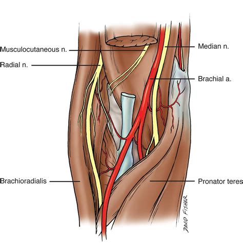 Cureus Relationship Of The Median And Radial Nerves At The Elbow