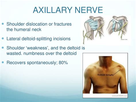 Ppt Peripheral Nerve Injuries Powerpoint Presentation Free Download