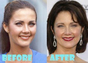 Lynda Carter Plastic Surgery Before And After Pictures Lovely Surgery