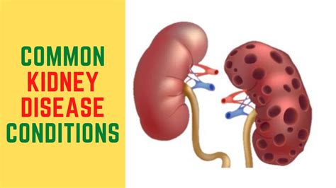 Common Kidney Disease Conditions What Are Some Kidney Conditions