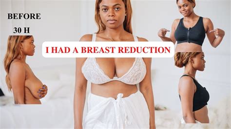 Dadou Chic MY BREAST REDUCTION STORY MY RESULTS