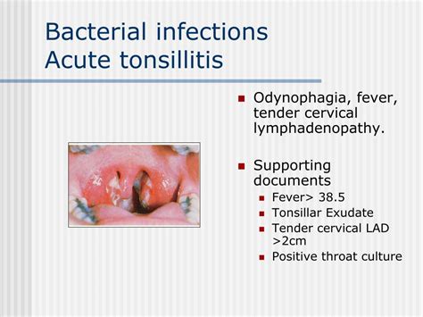 Ppt Head And Neck Diseases Powerpoint Presentation Free Download