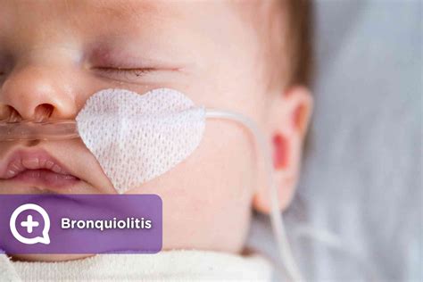 Bronquiolitis Mediquo