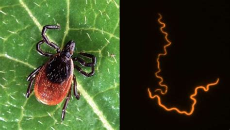 Breakthrough Paves Way For New Lyme Disease Treatment